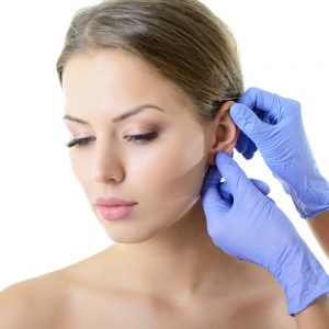 otoplasty